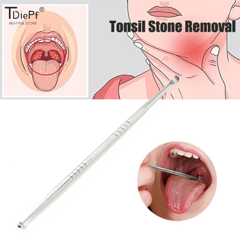 스테인리스 스틸 편석 제거 귀 왁스 제거 도구, 구강  - Ear Wax Remover 리뷰 및 가격